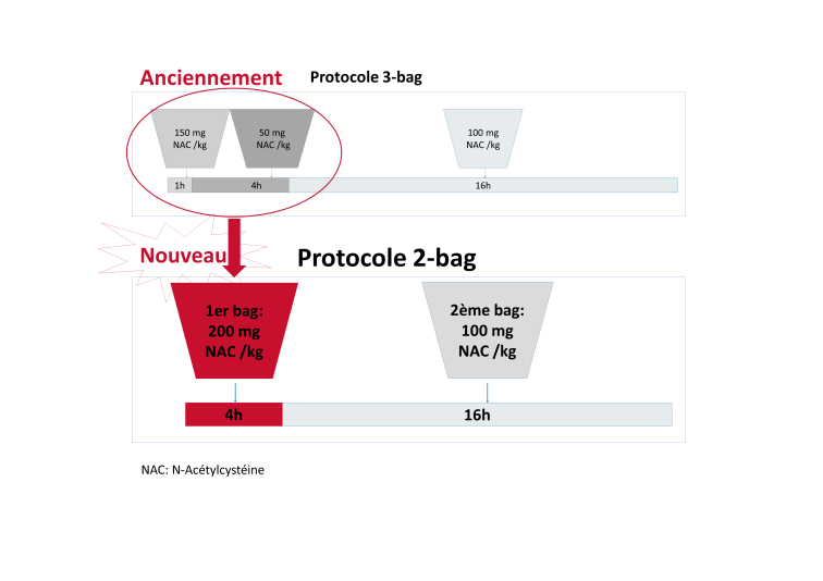 Nouveau : Protocole à 2-bag au lieu de l’ancien protocole à 3-bag (schéma Prescott)