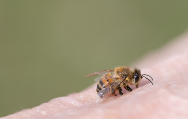 Abeille domestique sur la peau humaine : les abeilles ne piquent que lorsqu’elles se sentent menacées.